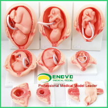 ANATOMY13 (12451) Taille naturelle 10 en 1 Processus de développement pour les modèles Foetus, Anatomie&gt; Modèles de grossesse 12451